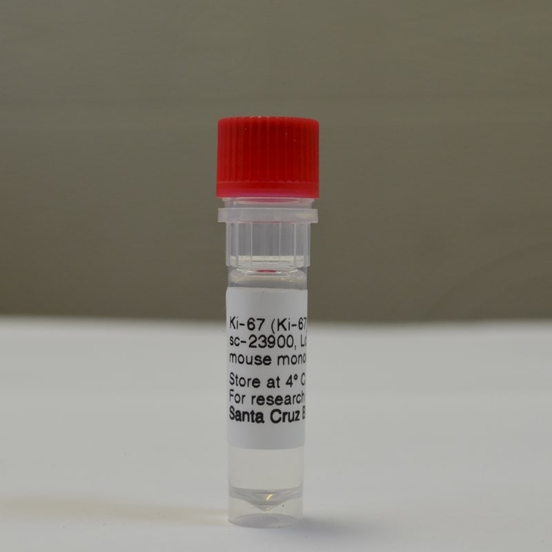 Ki-67 Antibody (Ki-67)